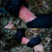 Rhino Rescue Burn Dressing